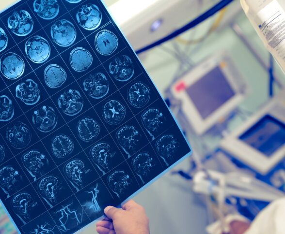 What is an acquired brain injury?